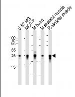 CRYAB Monoclonal Antibody (1329CT523.140.120)