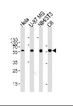 ATG5 Antibody in Western Blot (WB)