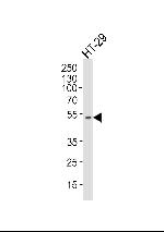 Aurora A Antibody in Western Blot (WB)