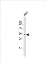 VWF Antibody in Western Blot (WB)