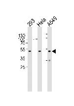 CBX8 Monoclonal Antibody (1214CT171.154.107)