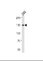 EphA6 Monoclonal Antibody (1426CT591.205.91.119)