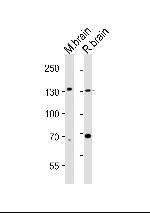 TrkC Monoclonal Antibody (1454CT394.87.35)
