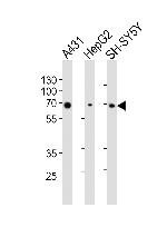 PKR Antibody in Western Blot (WB)