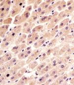 FER Monoclonal Antibody (1457CT181.12.17)