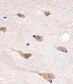 AATK Antibody in Immunohistochemistry (Paraffin) (IHC (P))
