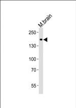 AATK Antibody in Western Blot (WB)