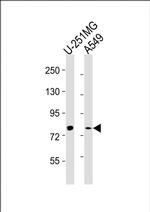 FES Antibody in Western Blot (WB)