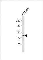 FES Antibody in Western Blot (WB)