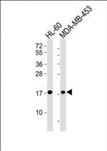 FHIT Monoclonal Antibody (1093CT23.1.2)