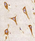 BAP31 Monoclonal Antibody (1502CT208.31.16)
