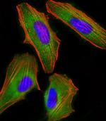 FAM120A Monoclonal Antibody (1501CT803.19.85.5)
