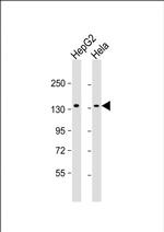 RBM6 Monoclonal Antibody (1583CT111.17.7.37)