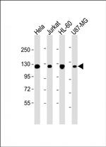 RNF20 Monoclonal Antibody (1594CT552.128.36)