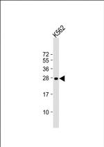 RAB27A Monoclonal Antibody (1590CT813.266.26)