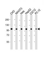 MCM3 Monoclonal Antibody (1593CT377.41.73)