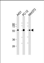 MiTF Antibody in Western Blot (WB)