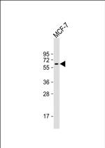 YES1 Monoclonal Antibody (1612CT505.7.50)