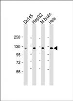 DAB2IP Monoclonal Antibody (1626CT702.263.21)