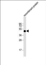 FAT1 Monoclonal Antibody (1634CT464.1.9)