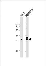 TPM3 Monoclonal Antibody (1649CT306.29.13)