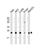 RAB1B Monoclonal Antibody (1673CT571.17.71)