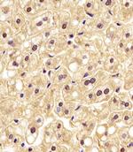 PGK1 Antibody in Immunohistochemistry (Paraffin) (IHC (P))