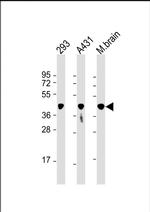 PGK1 Antibody in Western Blot (WB)