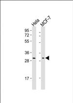 RAB20 Monoclonal Antibody (1694CT210.142.16)