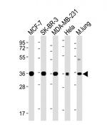 WNT4 Monoclonal Antibody (1698CT540.169.185)