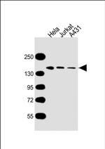 MYBBP1A Monoclonal Antibody (1702CT711.87.46)