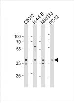 AMPK beta-1 Monoclonal Antibody (1420CT832.86.25)