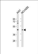SERPINB3 Monoclonal Antibody (798CT5.2.2)