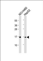 IFITM3 Monoclonal Antibody (1082CT14.1.3.1)