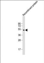 AKAP13 Monoclonal Antibody (1742CT411.87.24)