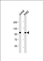 PRDM16 Monoclonal Antibody (1740CT793.52.44)