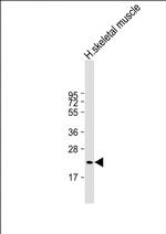 FNDC5 Monoclonal Antibody (1736CT532.85.53.92)