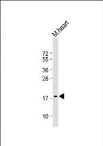ANP Monoclonal Antibody (1761CT158.12.76)
