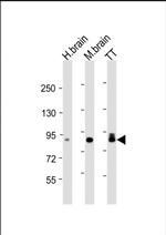DCLK1 Monoclonal Antibody (1751CT665.1.72)