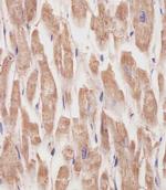 KANK1 Monoclonal Antibody (1773CT634.49.61)