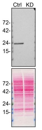 RAB14 Antibody