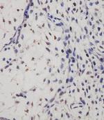SUFU Monoclonal Antibody (1783CT536.263.29)