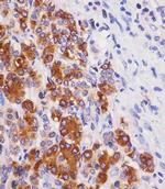 REG3G Monoclonal Antibody (1790CT313.66.2)