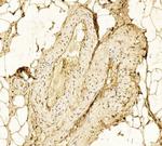 HK2 Antibody in Immunohistochemistry (Paraffin) (IHC (P))