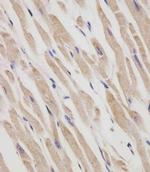 RANBP9 Monoclonal Antibody (1815CT202.22.8.37)