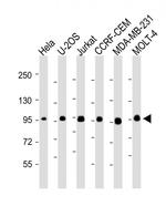 RANBP9 Antibody in Western Blot (WB)
