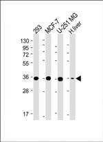 PDXK Antibody in Western Blot (WB)