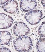 MBD2 Monoclonal Antibody (1812CT625.9.45)