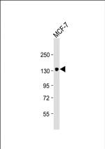 ABCB4 Monoclonal Antibody (1808CT346.21.23)