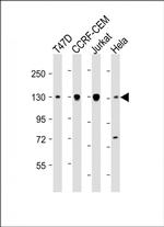 DNMT3A Monoclonal Antibody (1823CT281.43.36)